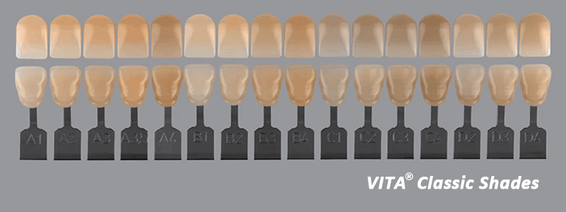Ghid de nuanță din zirconiu dentar durabil în stomatologie