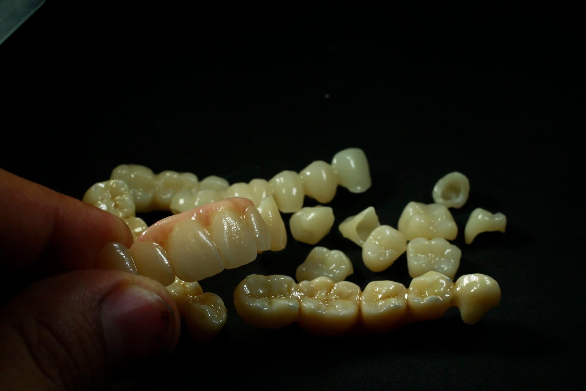 Material de laborator dentar Pulbere de porțelan
