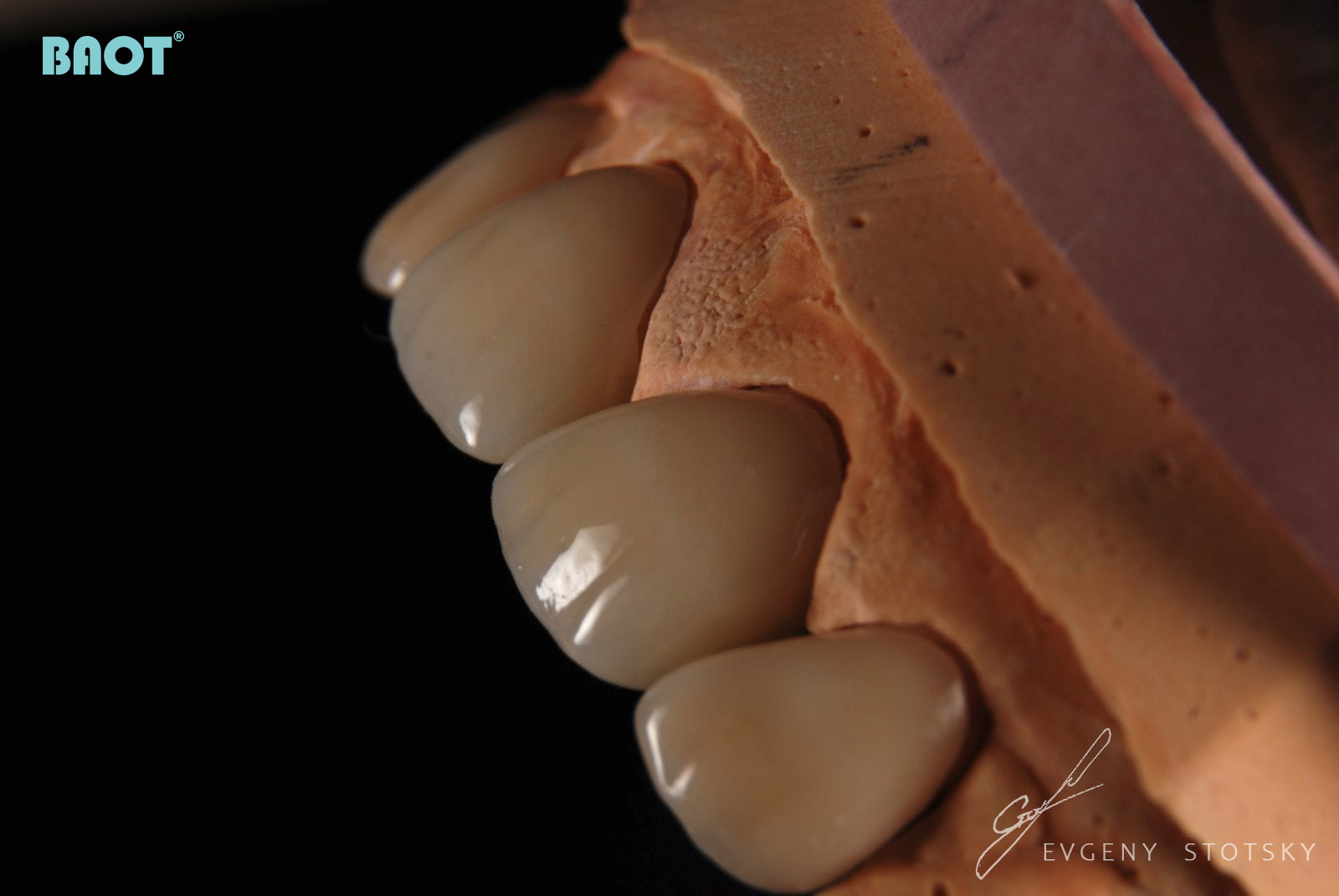 Pulbere de materiale ceramice dentare pentru restaurare