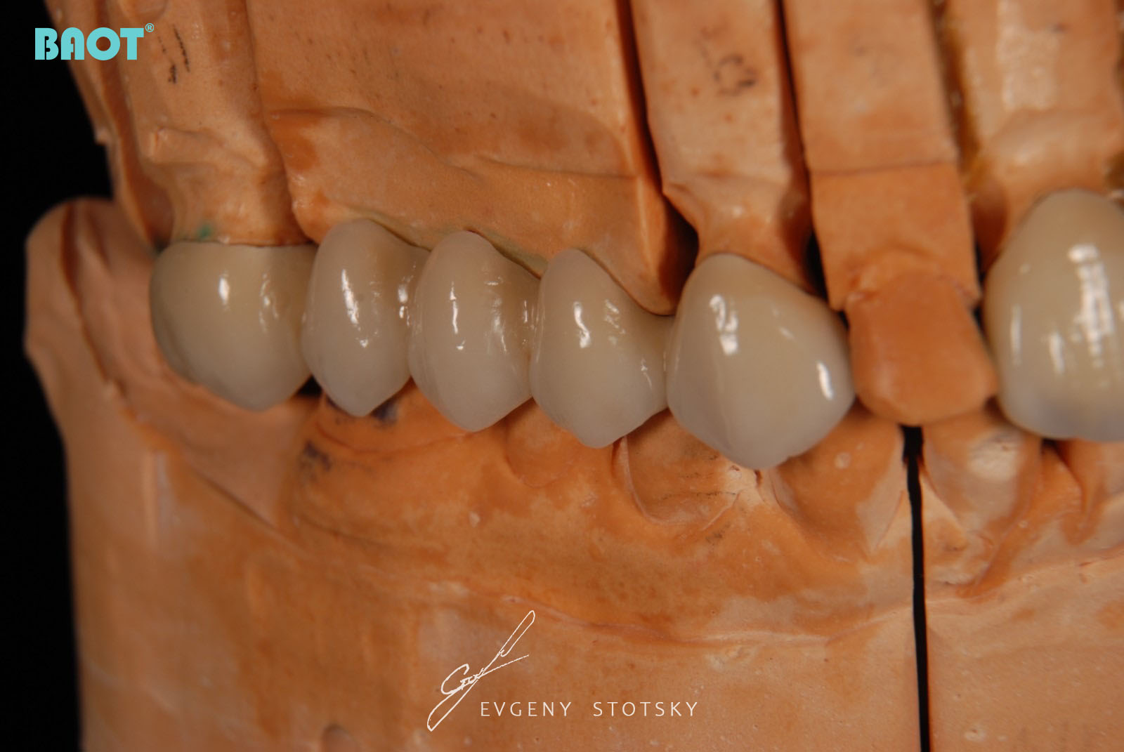 pulbere ceramica dentara pentru laborator dentar
