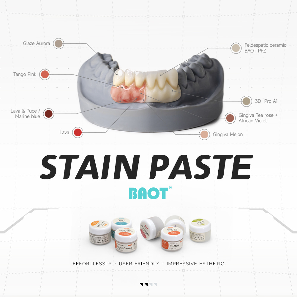 Kit de structură de glazură dentară pentru laborator