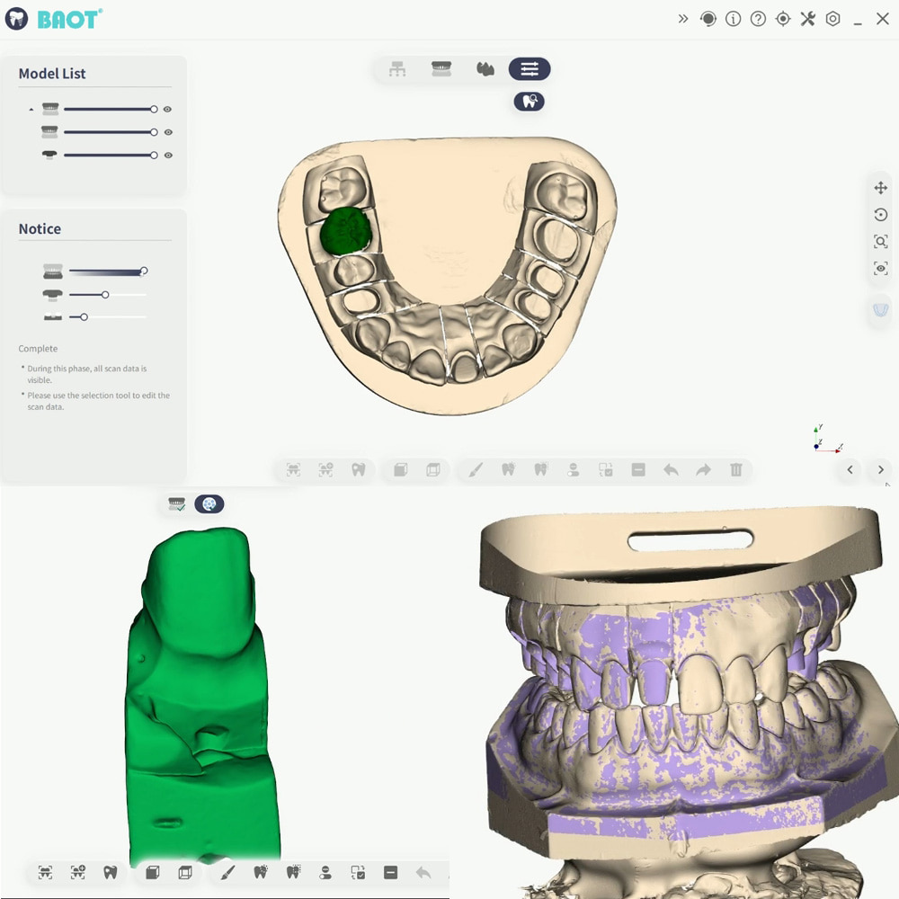 Scaner dentar 3D Scanare maxilar inferior