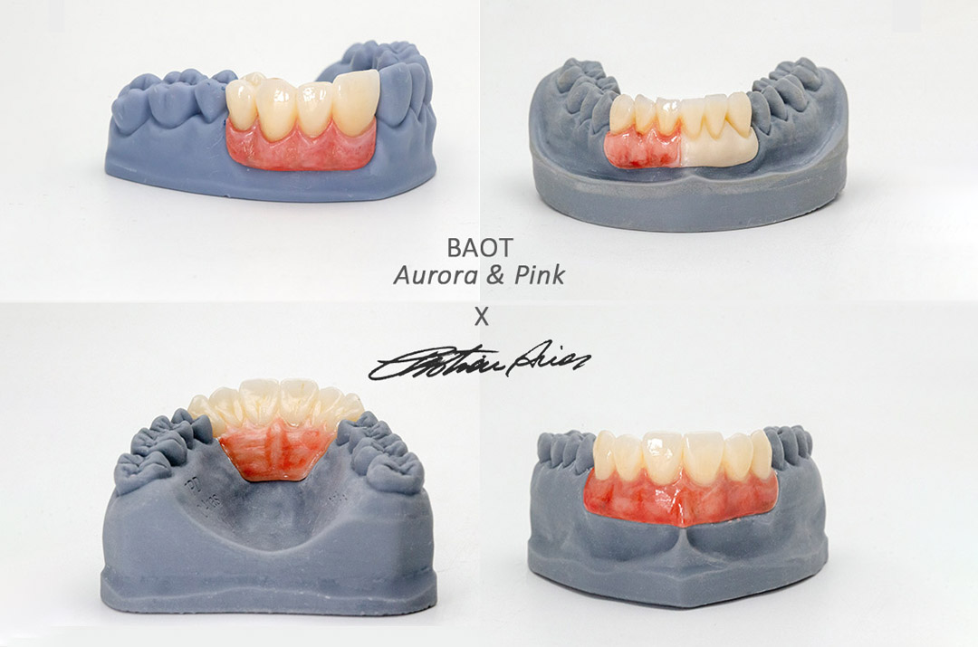 Sfaturi de glazura pentru petele dentare BAOT Aurora