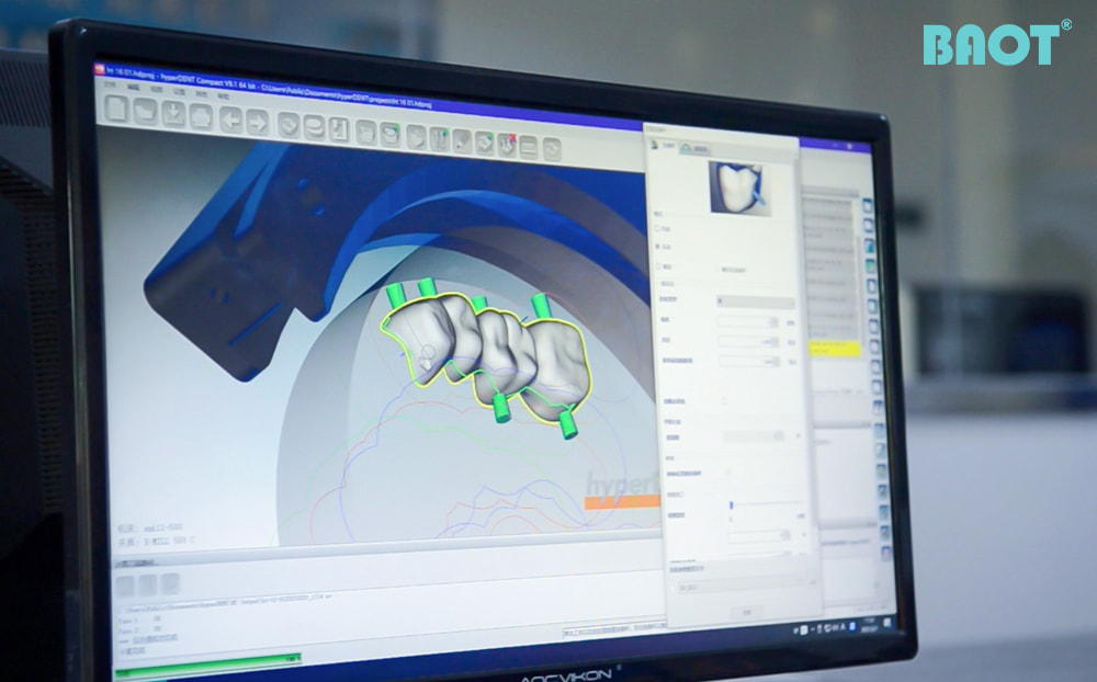 Rolul blocurilor de zirconiu în viitorul stomatologiei digitale