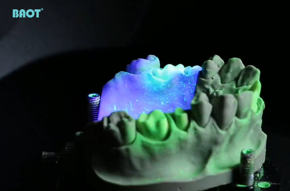 Principiile de bază și mecanismul de lucru al scanerelor dentare desktop